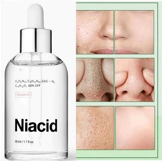Niacid Face Serum for skin treatment